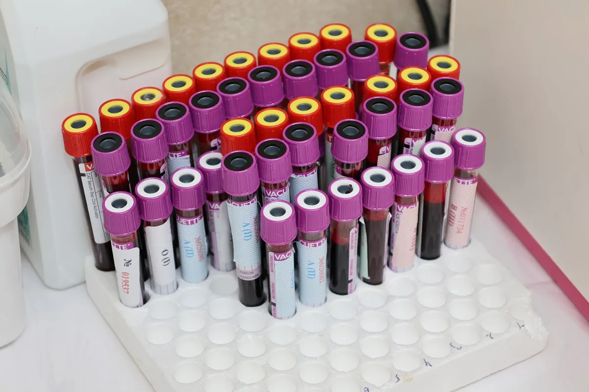 Rows of blood sample tubes in a rack, ready for laboratory testing